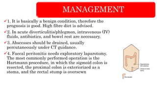 MANAGEMENT
1. It is basically a benign condition, therefore the
prognosis is good. High fibre diet is advised.
2. In acute diverticulitis/phlegmon, intravenous (IV)
fluids, antibiotics, and bowel rest are necessary.
3. Abscesses should be drained, usually
percutaneously under CT guidance.
4. Faecal peritonitis needs exploratory laparotomy.
The most commonly performed operation is the
Hartmann procedure, in which the sigmoid colon is
resected, the proximal colon is exteriorized as a
stoma, and the rectal stump is oversewn
 
