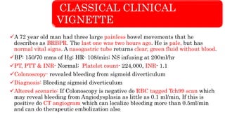 CLASSICAL CLINICAL
VIGNETTE
A 72 year old man had three large painless bowel movements that he
describes as BRBPR. The last one was two hours ago. He is pale, but has
normal vital signs. A nasogastric tube returns clear, green fluid without blood.
BP: 150/70 mms of Hg; HR- 108/min; NS infusing at 200ml/hr
PT, PTT & INR- Normal; Platelet count- 224,000, INR- 1.1
Colonoscopy- revealed bleeding from sigmoid diverticulum
Diagnosis: Bleeding sigmoid diverticulum
Altered scenario: If Colonoscopy is negative do RBC tagged Tch99 scan which
may reveal bleeding from Angiodysplasia as little as 0.1 ml/min, If this is
positive do CT angiogram which can localize bleeding more than 0.5ml/min
and can do therapeutic embolization also
 