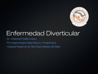 Enfermedad Diverticular
Dr. Cristóbal Padilla López
R1 Imagenología Diagnóstica y Terapéutica
Hospital Regional de Alta Especialidad del Bajío
 