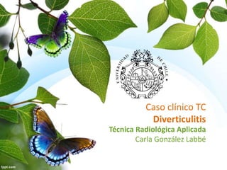 Caso clínico TC
Diverticulitis
Técnica Radiológica Aplicada
Carla González Labbé
 