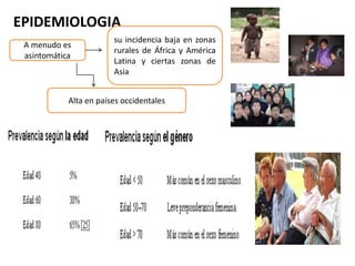 EPIDEMIOLOGIA
A menudo es
asintomática
su incidencia baja en zonas
rurales de África y América
Latina y ciertas zonas de
Asia
Alta en países occidentales
 