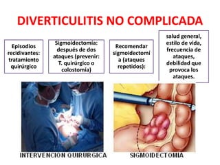 DIVERTICULITIS NO COMPLICADA
Episodios
recidivantes:
tratamiento
quirúrgico
Sigmoidectomía:
después de dos
ataques (prevenir:
T. quirúrgico o
colostomía)
Recomendar
sigmoidectomí
a (ataques
repetidos):
salud general,
estilo de vida,
frecuencia de
ataques,
debilidad que
provoca los
ataques.
 