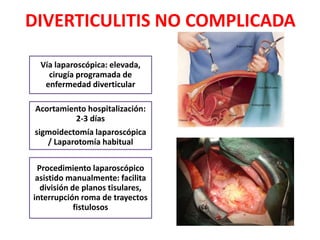 DIVERTICULITIS NO COMPLICADA
Vía laparoscópica: elevada,
cirugía programada de
enfermedad diverticular
Acortamiento hospitalización:
2-3 días
sigmoidectomía laparoscópica
/ Laparotomía habitual
Procedimiento laparoscópico
asistido manualmente: facilita
división de planos tisulares,
interrupción roma de trayectos
fistulosos
 