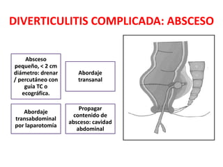 DIVERTICULITIS COMPLICADA: ABSCESO
Absceso
pequeño, < 2 cm
diámetro: drenar
/ percutáneo con
guía TC o
ecográfica.
Abordaje
transanal
Abordaje
transabdominal
por laparotomía
Propagar
contenido de
absceso: cavidad
abdominal
 
