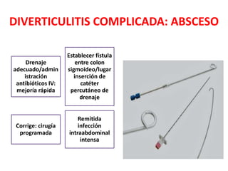 DIVERTICULITIS COMPLICADA: ABSCESO
Drenaje
adecuado/admin
istración
antibióticos IV:
mejoría rápida
Establecer fístula
entre colon
sigmoideo/lugar
inserción de
catéter
percutáneo de
drenaje
Corrige: cirugía
programada
Remitida
infección
intraabdominal
intensa
 