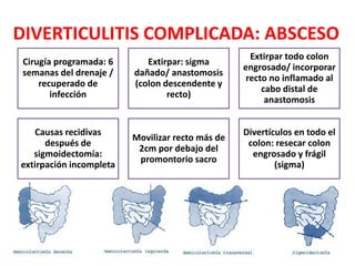 DIVERTICULITIS COMPLICADA: ABSCESO
Cirugía programada: 6
semanas del drenaje /
recuperado de
infección
Extirpar: sigma
dañado/ anastomosis
(colon descendente y
recto)
Extirpar todo colon
engrosado/ incorporar
recto no inflamado al
cabo distal de
anastomosis
Causas recidivas
después de
sigmoidectomía:
extirpación incompleta
Movilizar recto más de
2cm por debajo del
promontorio sacro
Divertículos en todo el
colon: resecar colon
engrosado y frágil
(sigma)
 