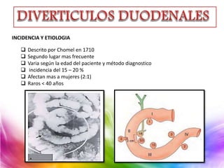 INCIDENCIA Y ETIOLOGIA
 Descrito por Chomel en 1710
 Segundo lugar mas frecuente
 Varia según la edad del paciente y método diagnostico
 incidencia del 15 – 20 %
 Afectan mas a mujeres (2:1)
 Raros < 40 años
 