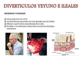 INCIDENCIA Y ETIOLOGIA
 Varia entre 0.1 y el 1.4 %
 Los divertículos yeyunales son mas grandes que los ileales
 Afectan a partir de la sexta decada de la vida
 Se debe a una disfusion motora del musculo liso del plexo
mienterico.
 