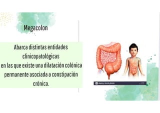 Diverticulitis-Diverticulosis-Vólvulo-Megacolon.pdf