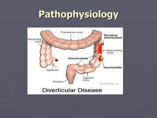 Pathophysiology 