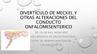 DIVERTÍCULO DE MECKEL Y
OTRAS ALTERACIONES DEL
CONDUCTO
ONFALOMESENTERICO
DR. OSCAR RAÚL RIVERA RÍOS
MEDICO RESIDENTE DE CIRUGÍA PEDIÁTRICA
TUTOR: DR. MARIANO MONTEALEGRE
CIRUJANO PEDIATRA
 