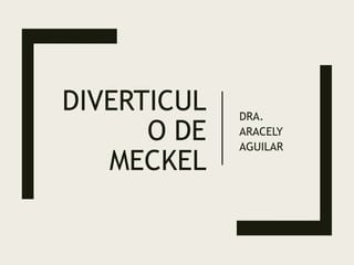 DIVERTICUL
O DE
MECKEL
DRA.
ARACELY
AGUILAR
 