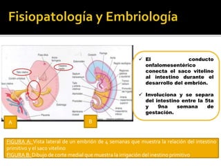  El conducto
onfalomesentérico
conecta el saco vitelino
al intestino durante el
desarrollo del embrión.
 Involuciona y se separa
del intestino entre la 5ta
y 9na semana de
gestación.
FIGURA A: Vista lateral de un embrión de 4 semanas que muestra la relación del intestino
primitivo y el saco vitelino
FIGURA B: Dibujo de corte medial que muestra la irrigación del inestino primitivo
A B
 