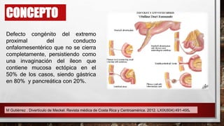CONCEPTO
Defecto congénito del extremo
proximal del conducto
onfalomesentérico que no se cierra
completamente, persistiendo como
una invaginación del íleon que
contiene mucosa ectópica en el
50% de los casos, siendo gástrica
en 80% y pancreática con 20%.
M Gutiérrez . Divertículo de Meckel. Revista médica de Costa Rica y Centroamérica. 2012. LXIX(604):491-495.
 