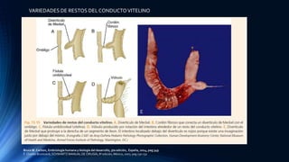 VARIEDADES DE RESTOS DEL CONDUCTOVITELINO
Bruce M. Carlson, Embriología humana y biología del desarrollo, 5ta edición, España, 2014, pag 349
F. Charles Brunicardi, SCHWARTZ MANUAL DE CIRUGÍA, 8ª edición, México, 2007, pag 730-731
 