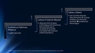 Guilhelmus Fabricios
Hildanus
• 1598 lo describe
Johann Friedrich Meckel
• 1809 describió las bases
embriológicas del divertículo,
demostrando que es
resultado de la atrofia
incompleta del conducto
onfalomesentérico.
Salzer y Deetz
• Casi 100 años después,
descubrimiento de mucosa
ectópica y la ulceración
asociada.complicación
hemorragica
M. Ruíz-Celorioa , F. Higuera-de la Tijerab y E. Pérez-Torresc, El divertículo de Meckel, Rev Med Hosp Gen Méx 2014;77(2):88-92
 