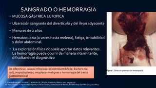 SANGRADO O HEMORRAGIA
• MUCOSA GÁSTRICA ECTOPICA
• Ulceración sangrante del divertículo y del íleon adyacente
• Menores de 2 años
• Hematoquezia (a veces hasta melena), fatiga, irritabilidad
y dolor abdominal.
• La exploración física no suele aportar datos relevantes.
La hemorragia puede ocurrir de manera intermitente,
dificultando el diagnóstico
Dx diferencial: causas infecciosas (Clostridium dificile, Escherichia
coli), angiodisplasias, neoplasias malignas o hemorragia del tracto
gastrointestinal
F. Charles Brunicardi, SCHWARTZ MANUAL DE CIRUGÍA, 8ª edición, México, 2007, pag 730-731
M. Ruíz-Celorioa , F. Higuera-de la Tijerab y E. Pérez-Torresc, El divertículo de Meckel, Rev Med Hosp Gen Méx 2014;77(2):88-92
 