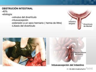 OBSTRUCIÓN INTESTINAL
-40%
-etiología:
-volvulus del divertículo
-intususcepción
-extensión a un saco herniario ( hernia de littre)
-Litiasis del divertículo

 