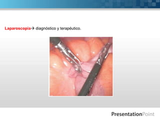 Laparoscopia diagnóstico y terapéutico.

 