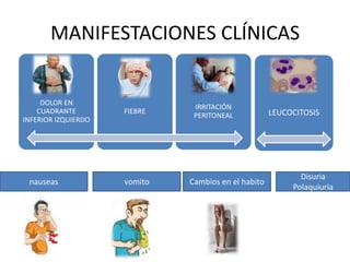 MANIFESTACIONES CLÍNICAS

DOLOR EN
CUADRANTE
INFERIOR IZQUIERDO

nauseas

FIEBRE

vomito

IRRITACIÓN
PERITONEAL

Cambios en el habito

LEUCOCITOSIS

Disuria
Polaquiuria

 