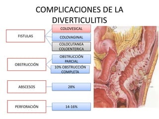COMPLICACIONES DE LA
DIVERTICULITIS
COLOVESICAL
FISTULAS

COLOVAGINAL
COLOCUTANEA
COLOENTERICA

OBSTRUCCIÓN

OBSTRUCCIÓN
PARCIAL
10% OBSTRUCCIÓN
COMPLETA

ABSCESOS

28%

PERFORACIÓN

14-16%

 