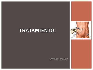 TRATAMIENTO

RICHARD ALVAREZ

 