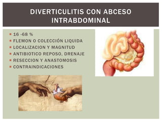 DIVERTICULITIS CON ABCESO
INTRABDOMINAL







16 -68 %
FLEMON O COLECCIÓN LIQUIDA
LOCALIZACION Y MAGNITUD
ANTIBIOTICO REPOSO, DRENAJE
RESECCION Y ANASTOMOSIS
CONTRAINDICACIONES

 