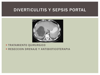 DIVERTICULITIS Y SEPSIS PORTAL

 TRATAMIENTO QUIRURGICO
 RESECCION DRENAJE Y ANTIBIOTICOTERAPIA

 