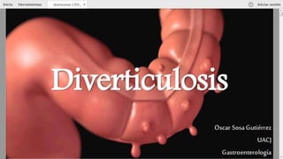 Diverticulos