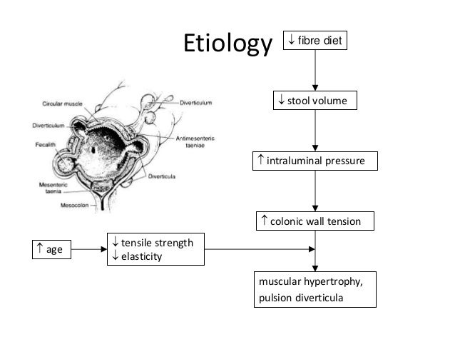 Image result for diverticulitis pathophysiology