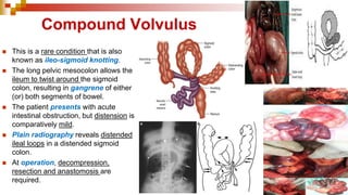 Compound Volvulus
◼ This is a rare condition that is also
known as ileo-sigmoid knotting.
◼ The long pelvic mesocolon allows the
ileum to twist around the sigmoid
colon, resulting in gangrene of either
(or) both segments of bowel.
◼ The patient presents with acute
intestinal obstruction, but distension is
comparatively mild.
◼ Plain radiography reveals distended
ileal loops in a distended sigmoid
colon.
◼ At operation, decompression,
resection and anastomosis are
required.
 