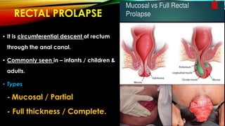 RECTAL PROLAPSE
• It is circumferential descent of rectum
through the anal canal.
• Commonly seen in – infants / children &
adults.
• Types
- Mucosal / Partial
- Full thickness / Complete.
 
