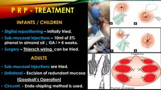 P R P - TREATMENT
• Digital repositioning – Initially tried.
• Sub-mucosal injections – 10ml of 5%
phenol in almond oil ↓ GA / > 6 weeks.
• Surgery – Thiersch wiring can be tried.
INFANTS / CHILDREN
ADULTS
• Sub-mucosal injections are tried.
• Unilateral - Excision of redundant mucosa
[Goodsall’s Operation]
• Circumf. - Endo-stapling method is used.
 