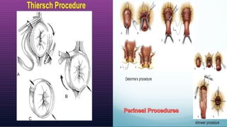 Perineal Procedures
 