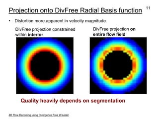 Divergence Visualization Improved Visualization and Quantification of 4D Flow Data using ...