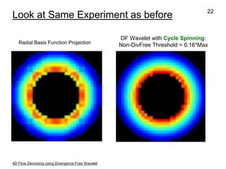 Divergence Visualization Improved Visualization and Quantification of 4D Flow Data using ...