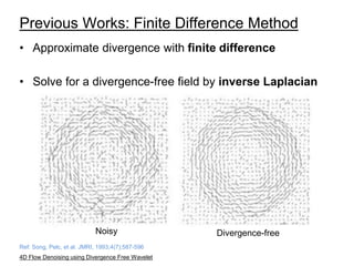 Divergence Visualization Improved Visualization and Quantification of 4D Flow Data using ...