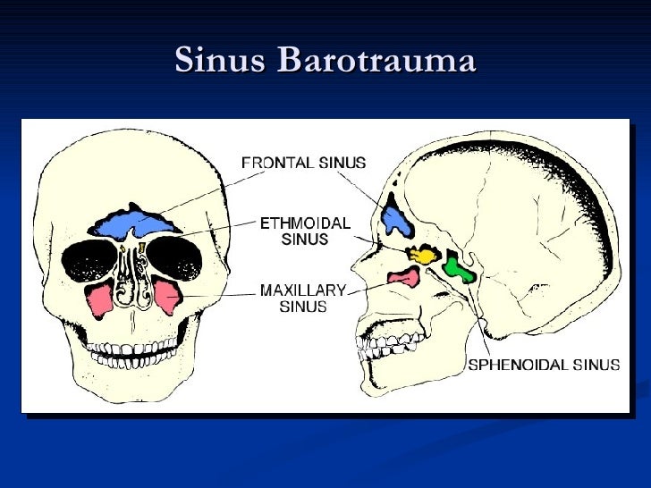 sinus pain diving sinus pain diving
