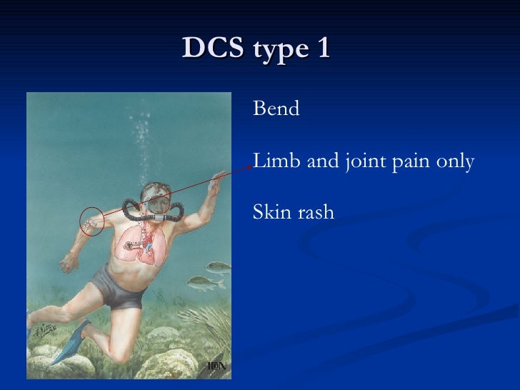 Diving accident