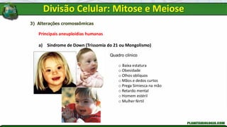 3) Alterações cromossômicas
Principais aneuploidias humanas
a) Síndrome de Down (Trissomia do 21 ou Mongolismo)
Quadro clínico
o Baixa estatura
o Obesidade
o Olhos oblíquos
o Mãos e dedos curtos
o Prega Simiesca na mão
o Retardo mental
o Homem estéril
o Mulher fértil
Divisão Celular: Mitose e Meiose
 