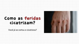Como as feridas
cicatrizam?
Como as feridas
cicatrizam?
Você já se cortou e cicatrizou?
 