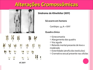 AAlltteerraaççõõeess CCrroommoossssôômmiiccaass 
Síndrome de Klinefelter (XXY) 
Só ocorre em homens 
Cariótipo: 44 A + XXY 
Quadro clínico 
o Ginecomastia 
o Alargamento dos quadris 
o Voz aguda 
o Retardo mental presente de leve a 
moderado 
o Esterilidade (atrofia dos testículos) 
o Cromatina sexual presente nas células 
 