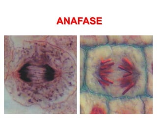 ANAFASE
 