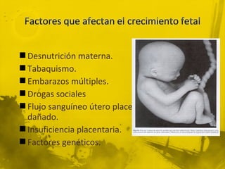  Desnutrición materna.
 Tabaquismo.
 Embarazos múltiples.
 Drogas sociales
 Flujo sanguíneo útero placentario
  dañado.
 Insuficiencia placentaria.
 Factores genéticos.
 