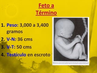 1. Peso: 3,000 a 3,400
   gramos
2. V-N: 36 cms
3. V-T: 50 cms
4. Testículo en escroto
 