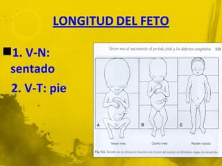 1. V-N:
 sentado
 2. V-T: pie
 