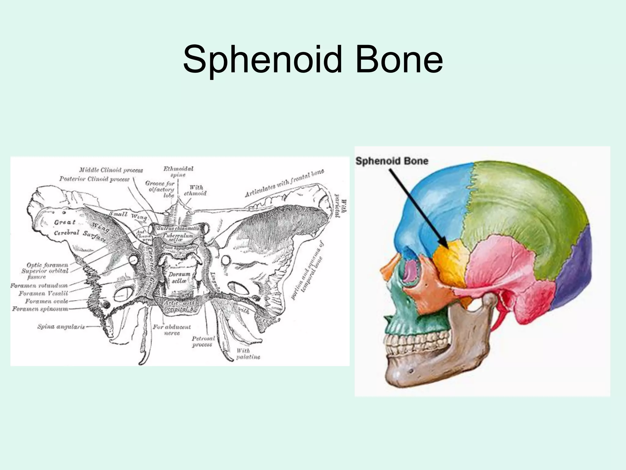 Sphenoid Bone
 