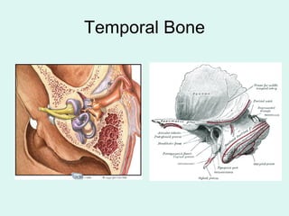 Temporal Bone
 