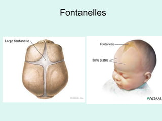 Fontanelles
 