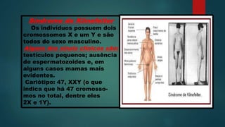 Síndrome de Klinefelter
Os indivíduos possuem dois
cromossomos X e um Y e são
todos do sexo masculino.
Alguns dos sinais clínicos são:
testículos pequenos; ausência
de espermatozoides e, em
alguns casos mamas mais
evidentes.
Cariótipo: 47, XXY (o que
indica que há 47 cromosso-
mos no total, dentre eles
2X e 1Y).
 